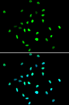 HDAC1 antibody