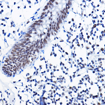 HDAC1 antibody