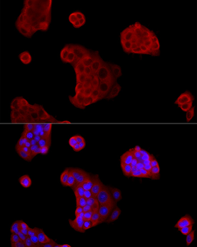 IRS-1 antibody