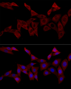 IRS-1 antibody