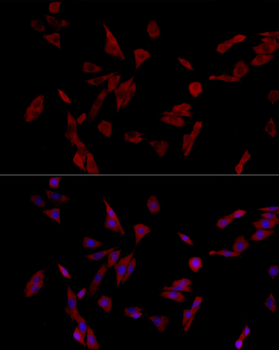 IRS-1 antibody