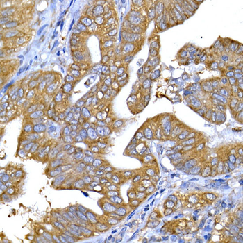 IRS-1 antibody