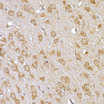 IRS-1 antibody