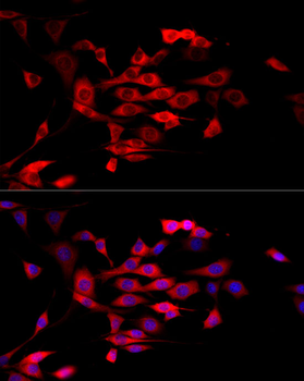 MTAP antibody