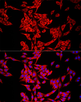 MTAP antibody