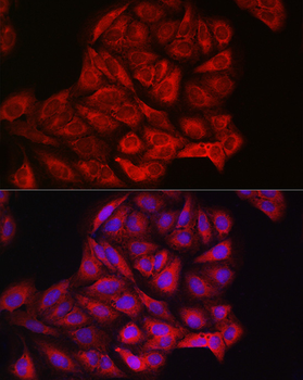 PI3 Kinase p110 alpha antibody