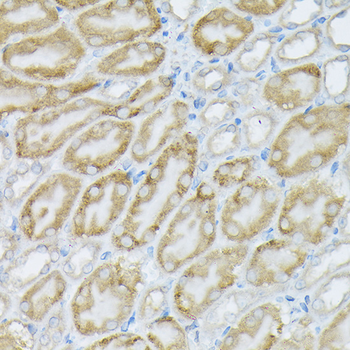 PI3 Kinase p110 alpha antibody