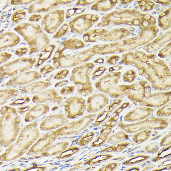 PI3 Kinase p110 alpha antibody