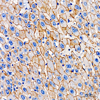 N Cadherin antibody