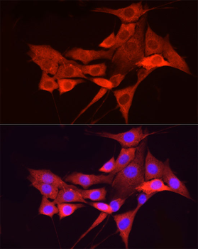 CHUK antibody