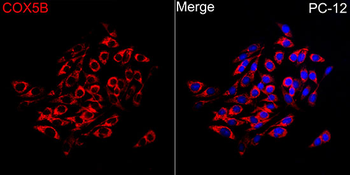 COX5B antibody