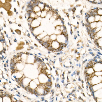 COX5B antibody