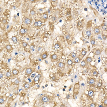 COX5B antibody