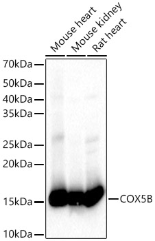 COX5B antibody