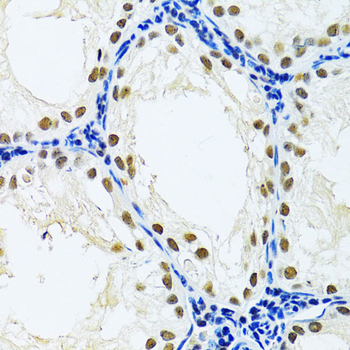 DDB1 antibody