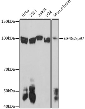 EIF4G2 antibody