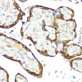 IFNAR2 antibody