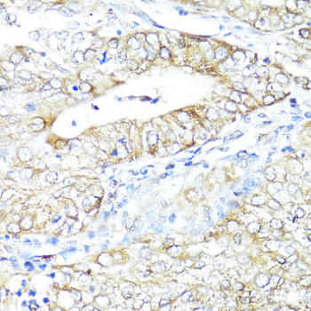 IFNAR2 antibody