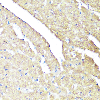 IFNAR2 antibody