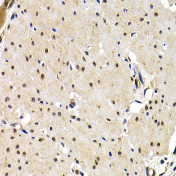 IRF-2 antibody