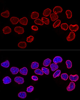 LMNB1 antibody