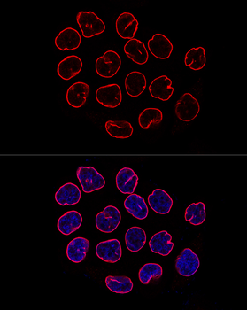 LMNB1 antibody