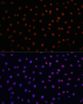 LMNB1 antibody