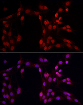 LMNB1 antibody