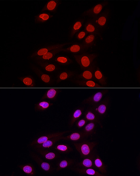 LMNB1 antibody