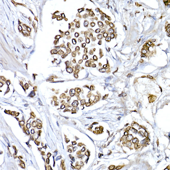 LMNB1 antibody