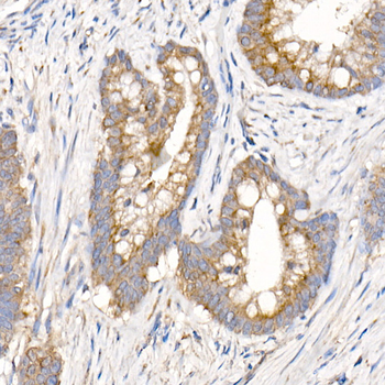 MMP14 antibody