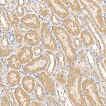 MMP14 antibody