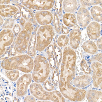 MMP14 antibody