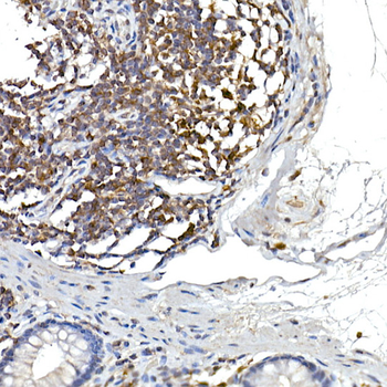 NFATC2 antibody