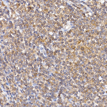 NFATC2 antibody