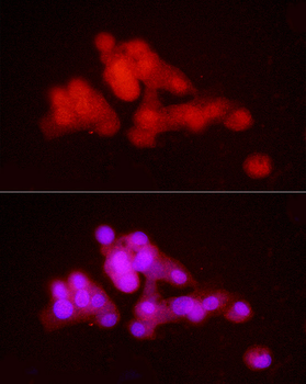 PCBP2 antibody