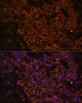 PCK1 antibody