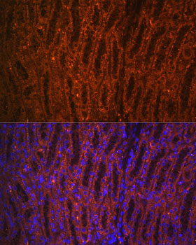 PCK1 antibody