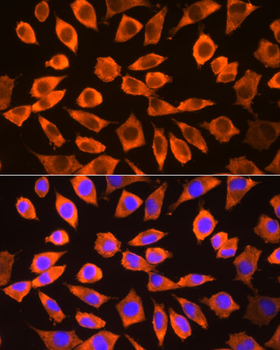 RPS3 antibody