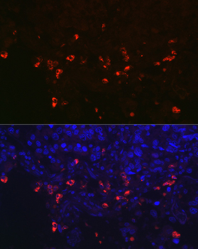 SFTPC antibody