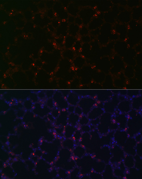 SFTPC antibody