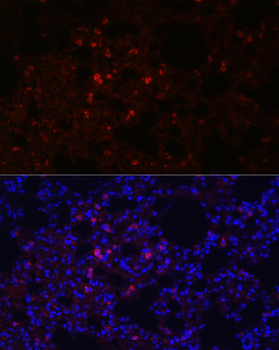 SFTPC antibody