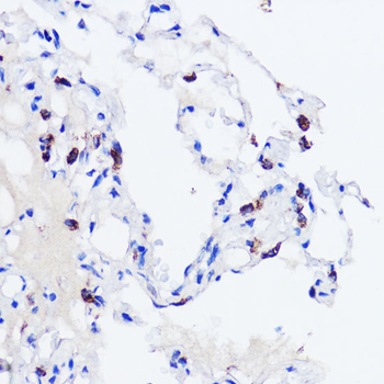 SFTPC antibody