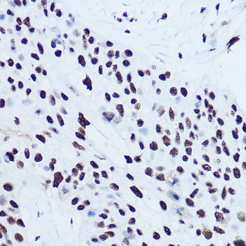 La Antigen antibody