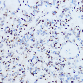 La Antigen antibody