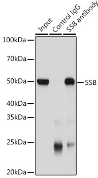 La Antigen antibody