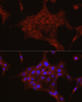 TGFBI antibody