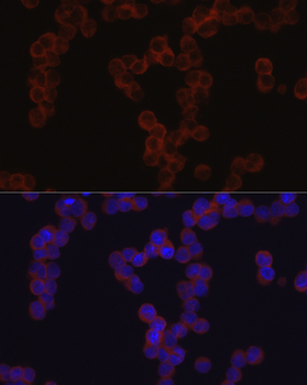 TGFBI antibody