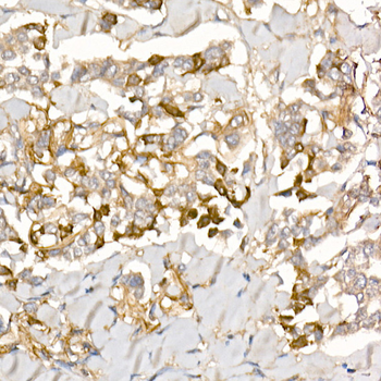 TGFBI antibody