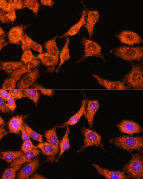 WASL antibody